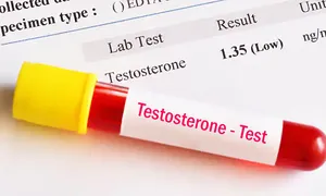 Dấu hiệu ngoài da cảnh báo giảm testosterone