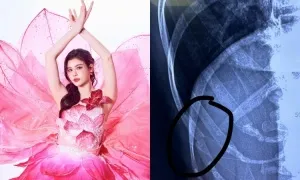 Trương Quỳnh Anh: 'Tôi liều khi bị gãy xương sườn vẫn nhảy' Trương Quỳnh Anh: 'Tôi liều khi bị gãy xương sườn vẫn nhảy'