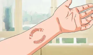 Vết thương do người cắn gây lây nhiễm bệnh gì? Vết thương do người cắn gây lây nhiễm bệnh gì?